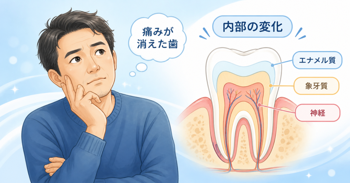 痛みが引いたむし歯放置のリスクとは？身体への影響と受診基準